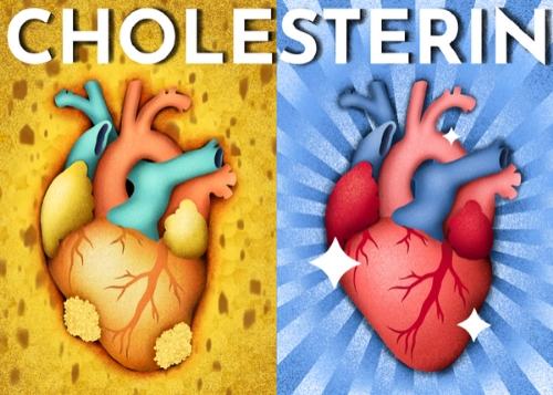 Cholesterin Post Thumbnail